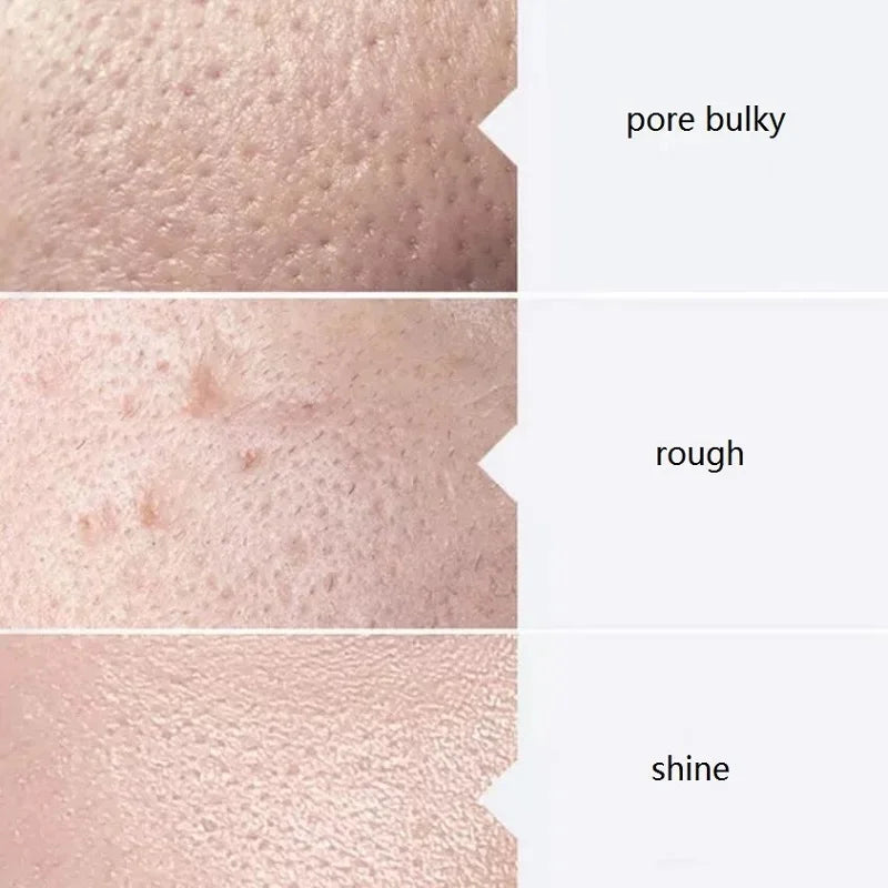 Aqua Peel Solution Kit 3 x 400ml — view 5