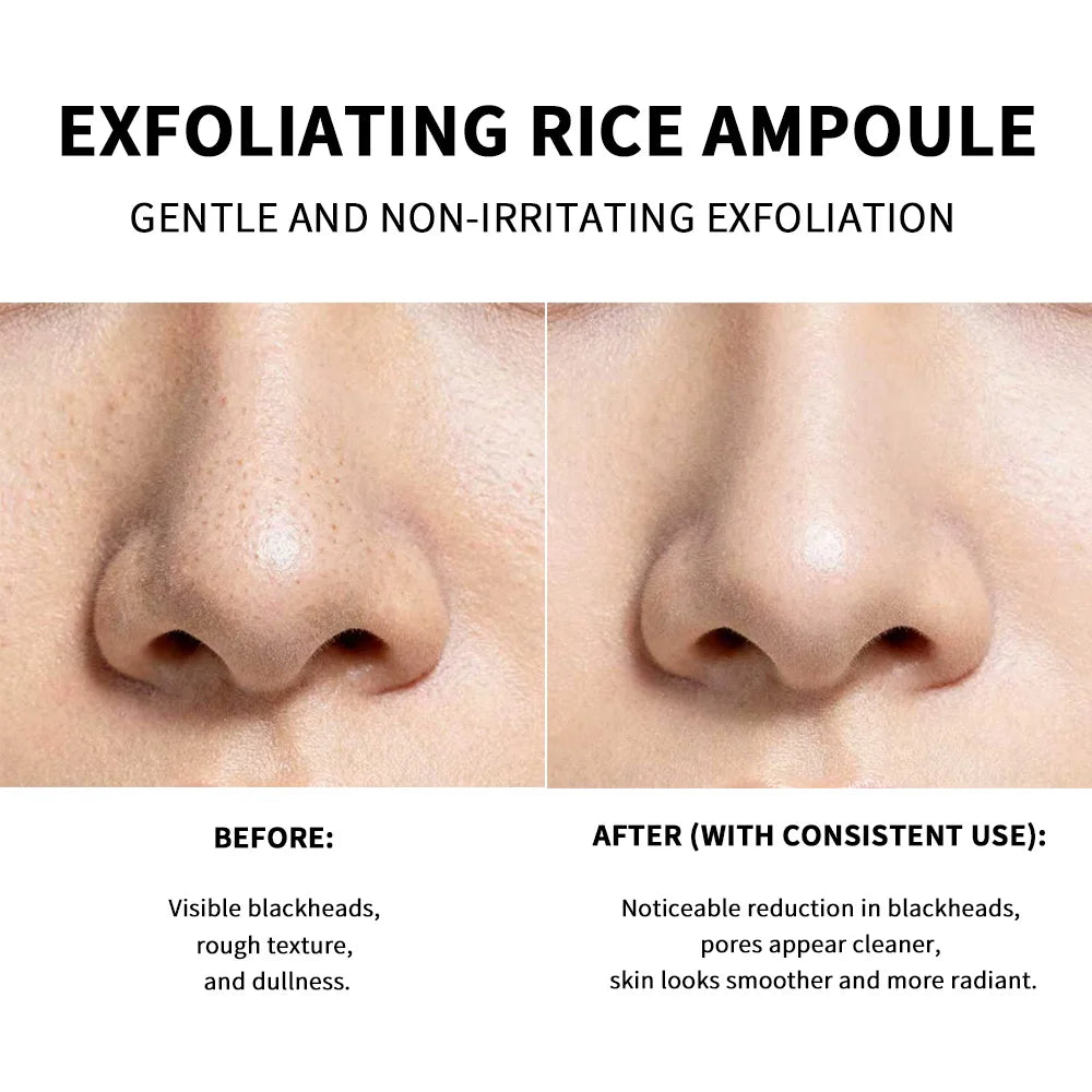 Rice Peeling Ampoule