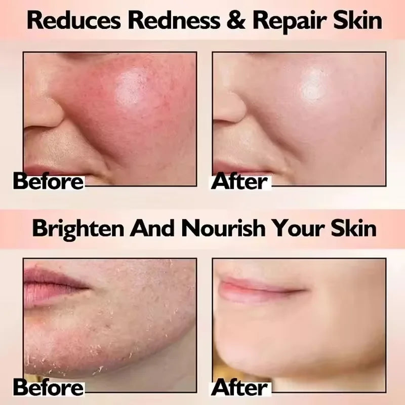 Redness Relief Moisturiser