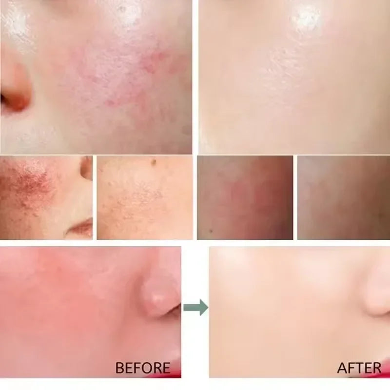Redness Relief Moisturiser
