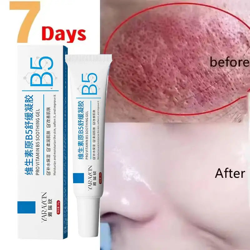 Redness Relief Moisturiser