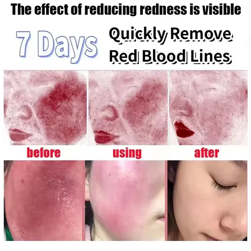 Redness Relief Moisturiser